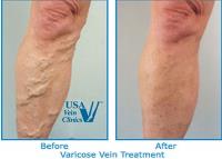 USA Vein Clinics in Congress Parkway, IL image 6